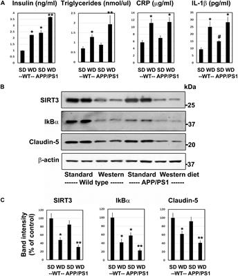 Effects of Lipotoxicity in Brain Microvascular Endothelial Cells During Sirt3 Deficiency-Potential Role in Comorbid Alzheimer’s Disease